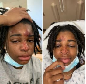 Evans documents her injuries sustained on April 4th.